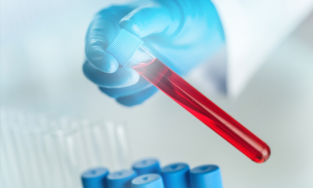 Liquid Biopsies Provide New Cancer Treatment Clues